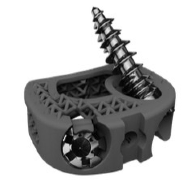 3D titán cervical stand alone cage - BMD ACIF GW ZP