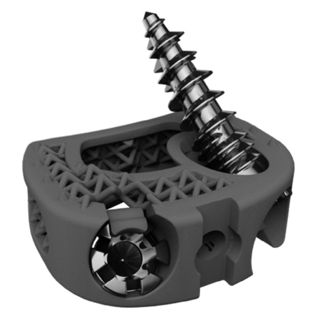 3D nyomtatott titán cervical stand alone cage - BMD ACIF GW ZP