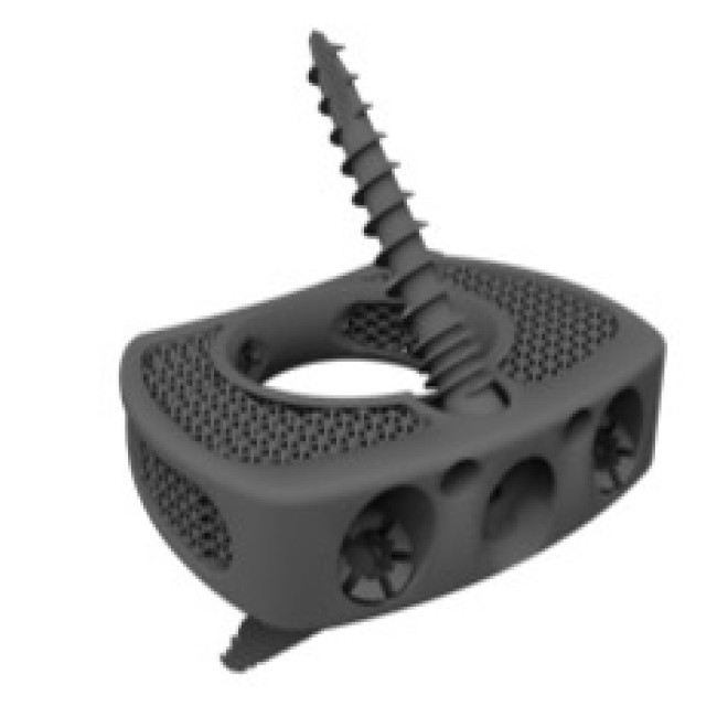 3D titán lumbal stand alone cage - BMD ALIF SA