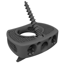 3D nyomtatott titán lumbal stand alone cage - BMD ALIF SA