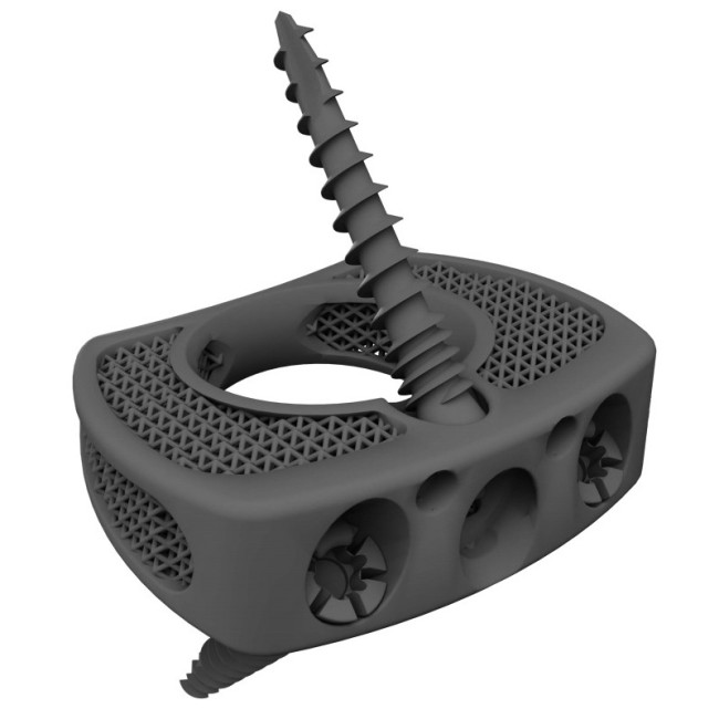 3D nyomtatott titán lumbal stand alone cage - BMD ALIF SA 3D nyomtatott titán lumbal stand alone cage - BMD ALIF SA